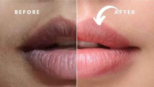 How to Get Dark Lips to Pink Lips Naturally at Home - Dreemato