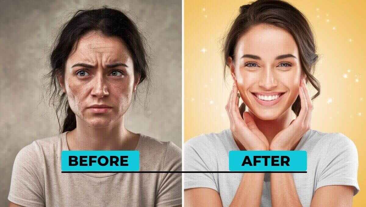 Brighten Dull Skin: Causes and Treatment Solutions