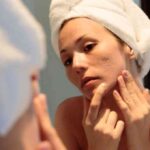 Girl applying aloe vera to remove pimple marks naturally at home fast, simple skincare routine for clear glowing skin in 2025