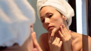 Girl applying aloe vera to remove pimple marks naturally at home fast, simple skincare routine for clear glowing skin in 2025