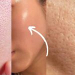 Woman applying natural remedy to shrink large pores on face using clay mask and aloe vera, effective 2025 pore-tightening tips